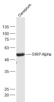 Lane 1: Mouse Cerebrum lysates probed with SIRP Alpha Polyclonal Antibody, Unconjugated (bs-2708R) at 1:1000 dilution and 4˚C overnight incubation. Followed by conjugated secondary antibody incubation at 1:20000 for 60 min at 37˚C.