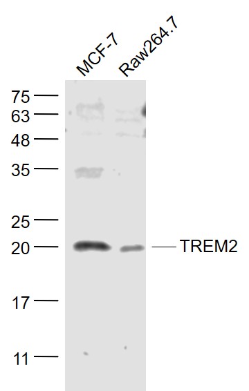 Lane 1: MCF-7 cell lysates; Lane 2: Raw264.7 cell lysates probed with TREM2 Polyclonal Antibody, Unconjugated (bs-2723R) at 1:1000 dilution and 4˚C overnight incubation. Followed by conjugated secondary antibody incubation at 1:20000 for 60 min at 37˚C.