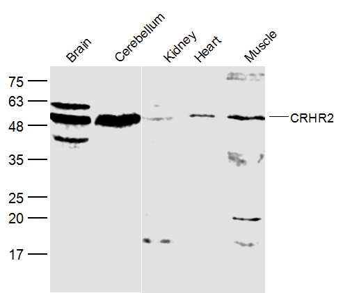 Lane 1: Mouse Brain lysates; Lane 2: Mouse Cerebellum lysates; Lane 3: Mouse Kidney lysates; Lane 4: Mouse Heart cell lysates ; Lane 5: Mouse Muscle lysates probed with CRHR2 Polyclonal Antibody, Unconjugated (bs-2792R) at 1:1000 dilution and 4˚C overnight incubation. Followed by conjugated secondary antibody incubation at 1:20000 for 60 min at 37˚C.