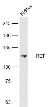 Lane 1: Mouse Kidney lysates probed with RET Polyclonal Antibody, Unconjugated (bs-2793R) at 1:1000 dilution and 4˚C overnight incubation. Followed by conjugated secondary antibody incubation at 1:20000 for 60 min at 37˚C.