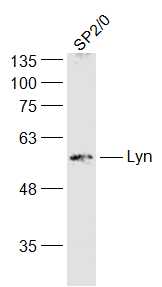 Lane 1: Mouse SP2\/0 cell lysates probed with Lyn Polyclonal Antibody, Unconjugated (bs-2906R) at 1:1000 dilution and 4˚C overnight incubation. Followed by conjugated secondary antibody incubation at 1:20000 for 60 min at 37˚C.