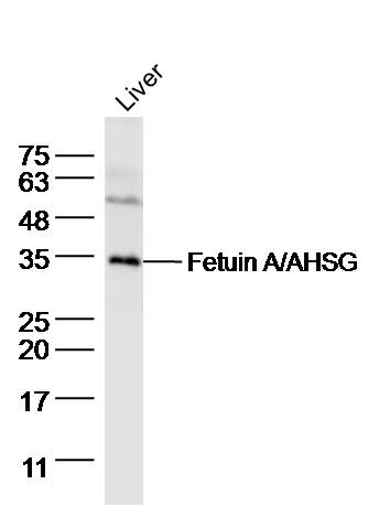 Lane 1: Mouse Liver lysates probed with AHSG Polyclonal Antibody, Unconjugated (bs-2922R) at 1:1000 dilution and 4˚C overnight incubation. Followed by conjugated secondary antibody incubation at 1:20000 for 60 min at 37˚C.
