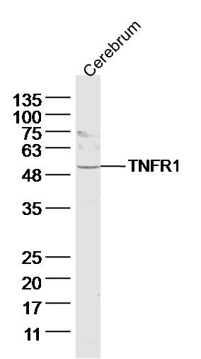 Lane 1: Rat Cerebrum lysates probed with TNF Receptor I Polyclonal Antibody, Unconjugated (bs-2941R) at 1:1000 dilution and 4˚C overnight incubation. Followed by conjugated secondary antibody incubation at 1:20000 for 60 min at 37˚C.