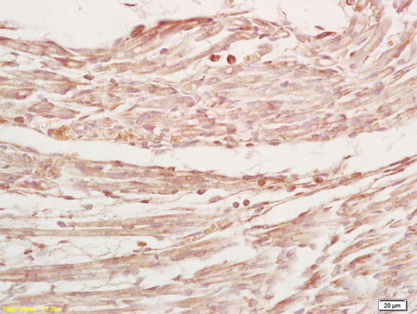 Formalin-fixed and paraffin embedded mouse embryo labeled with Rabbit Anti MYPN Polyclonal Antibody, Unconjugated (bs-10366R) at 1:200 followed by conjugation to the secondary antibody and DAB staining