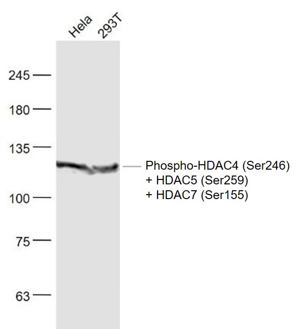 Lane 1: Hela cell lysates; Lane 2: 293T cell lysates probed with HDAC4(Ser246)/HDAC5(Ser259)/HDAC7(Ser155) Polyclonal Antibody, Unconjugated (bs-3073R) at 1:1000 dilution and 4˚C overnight incubation. Followed by conjugated secondary antibody incubation at 1:20000 for 60 min at 37˚C.