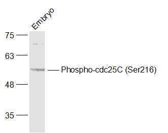 Lane 1: Mouse Embryo lysates probed with cdc25C (Ser216) Polyclonal Antibody, Unconjugated (bs-3096R) at 1:1000 dilution and 4˚C overnight incubation. Followed by conjugated secondary antibody incubation at 1:20000 for 60 min at 37˚C. Lane 1: Mouse Embryo lysates probed with cdc25C (Ser216) Polyclonal Antibody, Unconjugated (bs-3096R) at 1:1000 dilution and 4˚C overnight incubation. Followed by conjugated secondary antibody incubation at 1:20000 for 60 min at 37˚C.