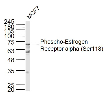 Lane 1: MCF-7 cell lysates probed with Estrogen Receptor alpha (S118) Polyclonal Antibody, Unconjugated (bs-3130R) at 1:1000 dilution and 4˚C overnight incubation. Followed by conjugated secondary antibody incubation at 1:20000 for 60 min at 37˚C.