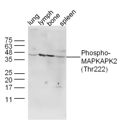 Lane 1: Mouse Lung lysates; Lane 2: Mouse Lymph lysates; Lane 3: Mouse Bone lysates; Lane 4: Mouse Spleen lysates probed with MAPKAPK2 (Thr222)  Polyclonal Antibody, Unconjugated (bs-3261R) at 1:1000 dilution and 4˚C overnight incubation. Followed by conjugated secondary antibody incubation at 1:20000 for 60 min at 37˚C.