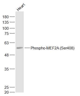 Lane 1: Mouse Heart lysates probed with MEF2A (Ser408) Polyclonal Antibody, Unconjugated (bs-3268R) at 1:1000 dilution and 4˚C overnight incubation. Followed by conjugated secondary antibody incubation at 1:20000 for 60 min at 37˚C.