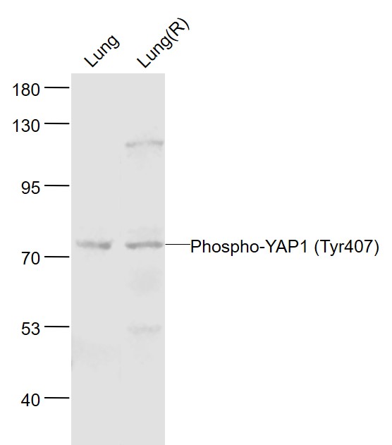 Lane 1: Mouse Lung lysates; Lane 2: Rat Lung lysates probed with YAP1(Tyr407) Polyclonal Antibody, Unconjugated (bs-3476R) at 1:1000 dilution and 4˚C overnight incubation. Followed by conjugated secondary antibody incubation at 1:20000 for 60 min at 37˚C.