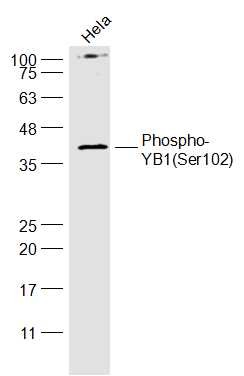 Lane 1: Hela cell lysates probed with YB1(Ser102) Polyclonal Antibody, Unconjugated (bs-3477R) at 1:1000 dilution and 4˚C overnight incubation. Followed by conjugated secondary antibody incubation at 1:20000 for 60 min at 37˚C.