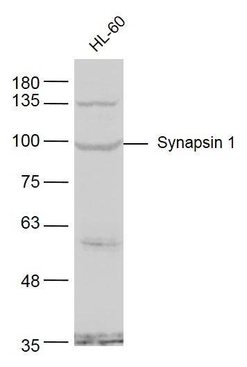 Lane 1: HL60 cell lysates probed with Synapsin 1 Polyclonal Antibody, Unconjugated (bs-3501R) at 1:1000 dilution and 4˚C overnight incubation. Followed by conjugated secondary antibody incubation at 1:20000 for 60 min at 37˚C.