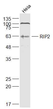 Lane 1: Hela cell lysates probed with RIP2 Polyclonal Antibody, Unconjugated (bs-3546R) at 1:1000 dilution and 4˚C overnight incubation. Followed by conjugated secondary antibody incubation at 1:20000 for 60 min at 37˚C.