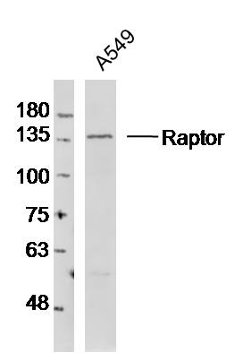 Lane 1: A549 cell lysates probed with Raptor Polyclonal Antibody, Unconjugated (bs-3559R) at 1:1000 dilution and 4˚C overnight incubation. Followed by conjugated secondary antibody incubation at 1:20000 for 60 min at 37˚C.