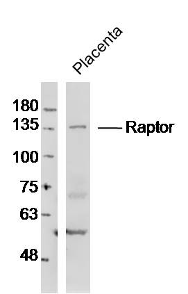 Lane 1: Mouse Placenta lysates probed with Raptor Polyclonal Antibody, Unconjugated (bs-3559R) at 1:1000 dilution and 4˚C overnight incubation. Followed by conjugated secondary antibody incubation at 1:20000 for 60 min at 37˚C.