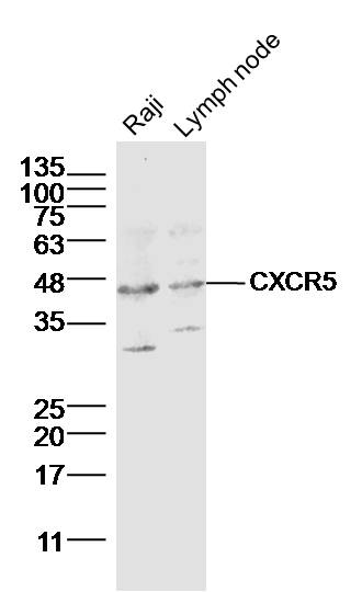 Lane 1: Raji cell lysates; Lane 2: Mouse Lymph node lysates probed with CXCR5 Polyclonal Antibody, Unconjugated (bs-3598R) at 1:1000 dilution and 4˚C overnight incubation. Followed by conjugated secondary antibody incubation at 1:20000 for 60 min at 37˚C.