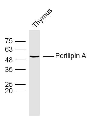 Lane 1: Mouse Thymus lysates probed with Perilipin A Polyclonal Antibody, Unconjugated (bs-3789R) at 1:1000 dilution and 4˚C overnight incubation. Followed by conjugated secondary antibody incubation at 1:20000 for 60 min at 37˚C.