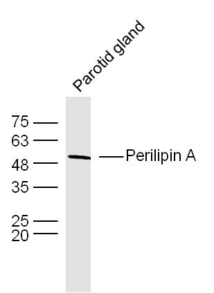 Lane 1: Mouse Parotid gland lysates probed with Perilipin A Polyclonal Antibody, Unconjugated (bs-3789R) at 1:1000 dilution and 4˚C overnight incubation. Followed by conjugated secondary antibody incubation at 1:20000 for 60 min at 37˚C.