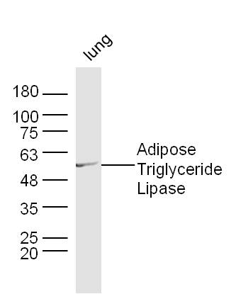 Lane 1: Mouse Lung lysates probed with Adipose Triglyceride Lipase Polyclonal Antibody, Unconjugated (bs-3831R) at 1:1000 dilution and 4˚C overnight incubation. Followed by conjugated secondary antibody incubation at 1:20000 for 60 min at 37˚C.
