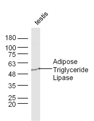 Lane 1: Mouse Testis lysates probed with Adipose Triglyceride Lipase Polyclonal Antibody, Unconjugated (bs-3831R) at 1:1000 dilution and 4˚C overnight incubation. Followed by conjugated secondary antibody incubation at 1:20000 for 60 min at 37˚C.