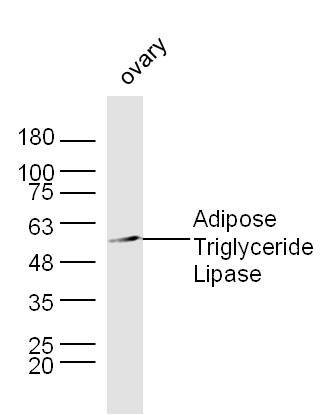 Lane 1: Mouse Ovary lysates probed with Adipose Triglyceride Lipase Polyclonal Antibody, Unconjugated (bs-3831R) at 1:1000 dilution and 4˚C overnight incubation. Followed by conjugated secondary antibody incubation at 1:20000 for 60 min at 37˚C.