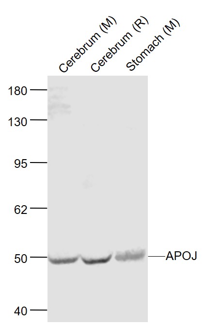 Apolipoprotein J Polyclonal Antibody Bioss