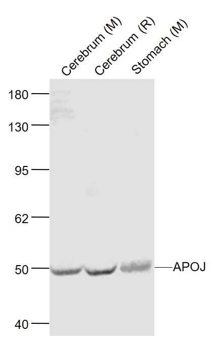 Lane 1: Mouse Cerebrum lysates; Lane 2: Rat Cerebrum lysates; Lane 3: Mouse Stomach lysates probed with Apolipoprotein J Polyclonal Antibody, Unconjugated (bs-1354R) at 1:1000 dilution and 4˚C overnight incubation. Followed by conjugated secondary antibody incubation at 1:20000 for 60 min at 37˚C.