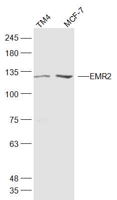 Lane 1: TM4 cell lysates; Lane 2: MCF-7 cell lysates probed with EMR2/CD312 Polyclonal Antibody, Unconjugated (bs-13634R) at 1:1000 dilution and 4˚C overnight incubation. Followed by conjugated secondary antibody incubation at 1:20000 for 60 min at 37˚C.