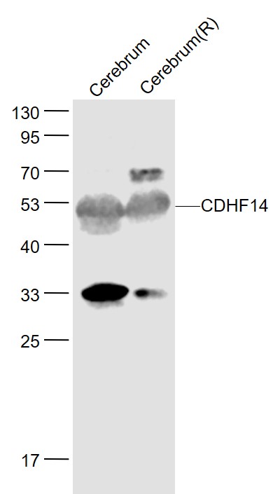 Lane 1: Mouse Cerebrum lysates; Lane 2: Rat Cerebrum lysates probed with CDHF14 Polyclonal Antibody, Unconjugated (bs-13721R) at 1:1000 dilution and 4˚C overnight incubation. Followed by conjugated secondary antibody incubation at 1:20000 for 60 min at 37˚C.