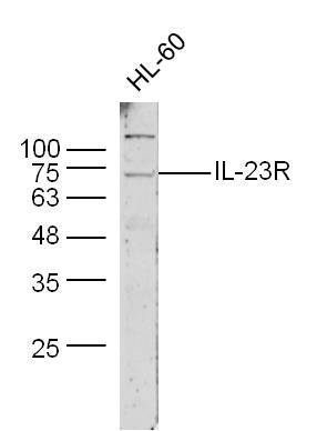 Lane 1: HL60 cell lysates probed with IL-23R Polyclonal Antibody, Unconjugated (bs-1460R) at 1:1000 dilution and 4˚C overnight incubation. Followed by conjugated secondary antibody incubation at 1:20000 for 60 min at 37˚C.