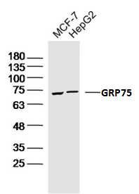 Lane 1: MCF-7 cell lysates; Lane 2: HepG2 cell lysates probed with GRP75 Polyclonal Antibody, Unconjugated (bs-1469R) at 1:1000 dilution and 4˚C overnight incubation. Followed by conjugated secondary antibody incubation at 1:20000 for 60 min at 37˚C.