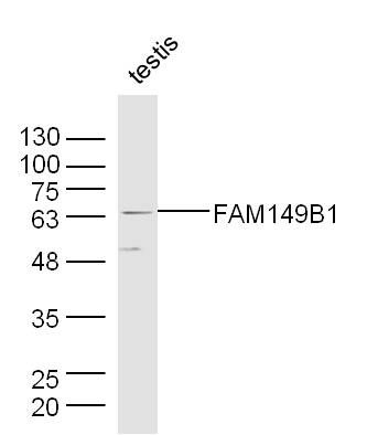 Lane 1: Mouse Testis lysates probed with FAM149B1 Polyclonal Antibody, Unconjugated (bs-14730R) at 1:1000 dilution and 4˚C overnight incubation. Followed by conjugated secondary antibody incubation at 1:20000 for 60 min at 37˚C. Lane 1: Mouse Testis lysates probed with FAM149B1 Polyclonal Antibody, Unconjugated (bs-14730R) at 1:1000 dilution and 4˚C overnight incubation. Followed by conjugated secondary antibody incubation at 1:20000 for 60 min at 37˚C.