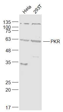 Lane 1: Hela cell lysates; Lane 2: 293T cell lysates probed with EIF2AK2/PKR Polyclonal Antibody, Unconjugated (bs-1493R) at 1:1000 dilution and 4˚C overnight incubation. Followed by conjugated secondary antibody incubation at 1:20000 for 60 min at 37˚C.
