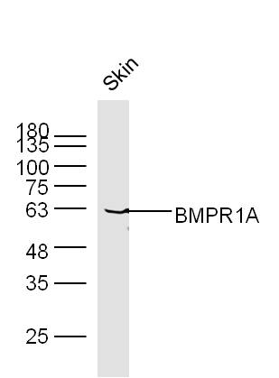 Lane 1: Mouse Skin lysates probed with BMPR1A Polyclonal Antibody, Unconjugated (bs-1509R) at 1:1000 dilution and 4˚C overnight incubation. Followed by conjugated secondary antibody incubation at 1:20000 for 60 min at 37˚C.