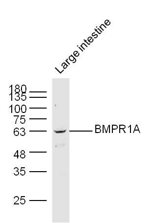Lane 1: Mouse Large intestine lysates probed with BMPR1A Polyclonal Antibody, Unconjugated (bs-1509R) at 1:1000 dilution and 4˚C overnight incubation. Followed by conjugated secondary antibody incubation at 1:20000 for 60 min at 37˚C.
