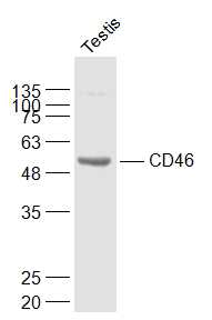 Lane 1: Mouse Testis lysates probed with CD46\/MCP Polyclonal Antibody, Unconjugated (bs-1529R) at 1:1000 dilution and 4˚C overnight incubation. Followed by conjugated secondary antibody incubation at 1:20000 for 60 min at 37˚C.