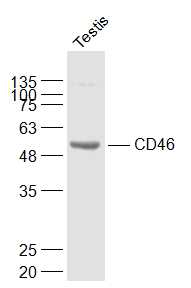 Lane 1: Mouse Testis lysates probed with CD46/MCP Polyclonal Antibody, Unconjugated (bs-1529R) at 1:1000 dilution and 4˚C overnight incubation. Followed by conjugated secondary antibody incubation at 1:20000 for 60 min at 37˚C.