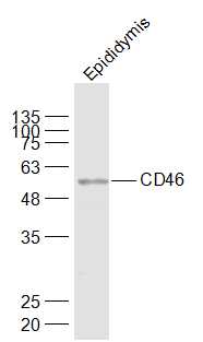 Lane 1: Mouse Epididymis lysates probed with CD46\/MCP Polyclonal Antibody, Unconjugated (bs-1529R) at 1:1000 dilution and 4˚C overnight incubation. Followed by conjugated secondary antibody incubation at 1:20000 for 60 min at 37˚C.