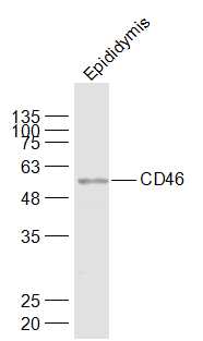 Lane 1: Mouse Epididymis lysates probed with CD46/MCP Polyclonal Antibody, Unconjugated (bs-1529R) at 1:1000 dilution and 4˚C overnight incubation. Followed by conjugated secondary antibody incubation at 1:20000 for 60 min at 37˚C.