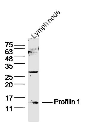 Lane 1: Mouse Lymph node lysates probed with Profilin 1 Polyclonal Antibody, Unconjugated (bs-1556R) at 1:1000 dilution and 4˚C overnight incubation. Followed by conjugated secondary antibody incubation at 1:20000 for 60 min at 37˚C.