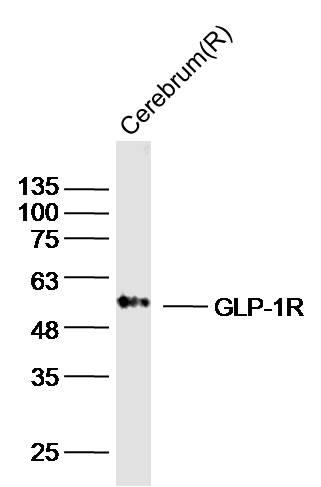 Lane 1: Rat Cerebrum lysates probed with GLP-1R Polyclonal Antibody, Unconjugated (bs-1559R) at 1:1000 dilution and 4˚C overnight incubation. Followed by conjugated secondary antibody incubation at 1:20000 for 60 min at 37˚C.