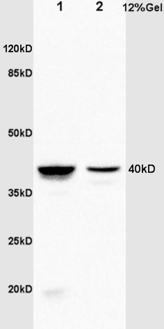Lane 1: Rat Kidney lysates; Lane 2: Rat Cerebrum lysates probed with Annexin A1 Polyclonal Antibody, Unconjugated (bs-1562R) at 1:1000 dilution and 4˚C overnight incubation. Followed by conjugated secondary antibody incubation at 1:20000 for 60 min at 37˚C.