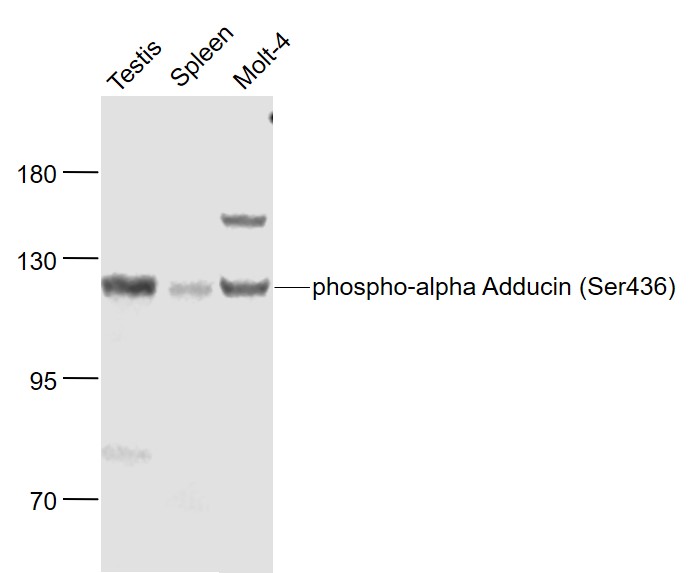 Lane 1: Mouse Testis lysates; Lane 2: Mouse Spleen lysates; Lane 3: Molt-4 cell lysates probed with alpha Adducin(Ser436) Polyclonal Antibody, Unconjugated (bs-15968R) at 1:1000 dilution and 4˚C overnight incubation. Followed by conjugated secondary antibody incubation at 1:20000 for 60 min at 37˚C.