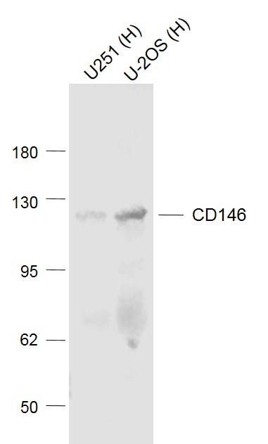 Lane 1: U251 cell lysates; Lane 2: U-2os cell lysates probed with CD146 Polyclonal Antibody, Unconjugated (bs-1618R) at 1:1000 dilution and 4˚C overnight incubation. Followed by conjugated secondary antibody incubation at 1:20000 for 60 min at 37˚C.