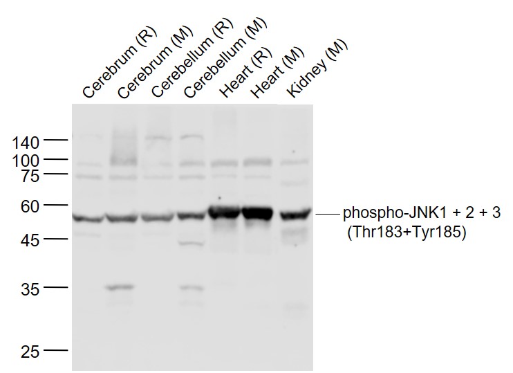 Lane 1: Rat Cerebrum lysates; Lane 2: Mouse Cerebrum lysates; Lane 3: Rat Cerebellum lysates; Lane 4: Mouse Cerebellum lysates; Lane 5: Rat Heart lysates; Lane 6: Mouse Heart lysates; Lane 7: Mouse Kidney lysates probed with JNK1+2+3 (T183+Y185) Polyclonal Antibody, Unconjugated (bs-1640R) at 1:1000 dilution and 4˚C overnight incubation. Followed by conjugated secondary antibody incubation at 1:20000 for 60 min at 37˚C.