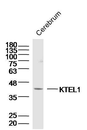 Lane 1: Mouse Cerebrum lysates probed with KTELC1/KTEL1 Polyclonal Antibody, Unconjugated (bs-16861R) at 1:1000 dilution and 4˚C overnight incubation. Followed by conjugated secondary antibody incubation at 1:20000 for 60 min at 37˚C. Lane 1: Mouse Cerebrum lysates probed with KTELC1/KTEL1 Polyclonal Antibody, Unconjugated (bs-16861R) at 1:1000 dilution and 4˚C overnight incubation. Followed by conjugated secondary antibody incubation at 1:20000 for 60 min at 37˚C.