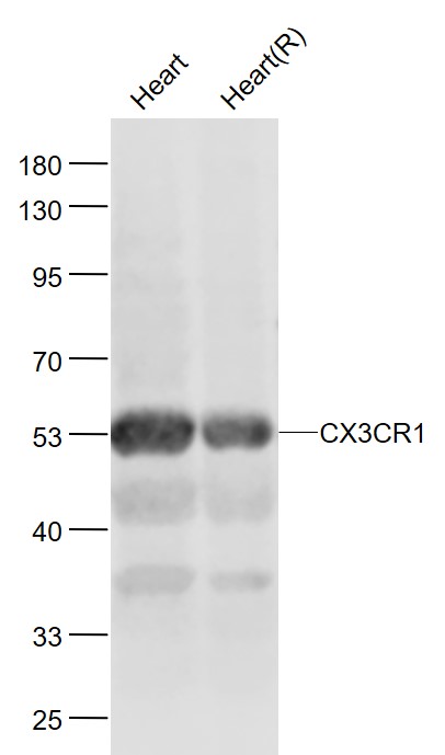 Lane 1: Mouse Heart lysates; Lane 2: Rat Heart lysates probed with CX3CR1 Polyclonal Antibody, Unconjugated (bs-1728R) at 1:1000 dilution and 4˚C overnight incubation. Followed by conjugated secondary antibody incubation at 1:20000 for 60 min at 37˚C.