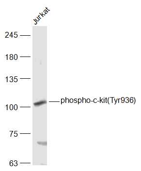 Lane 1: Jurkat cell lysates probed with c-kit(Tyr936) Polyclonal Antibody, Unconjugated (bs-1738R) at 1:1000 dilution and 4˚C overnight incubation. Followed by conjugated secondary antibody incubation at 1:20000 for 60 min at 37˚C.