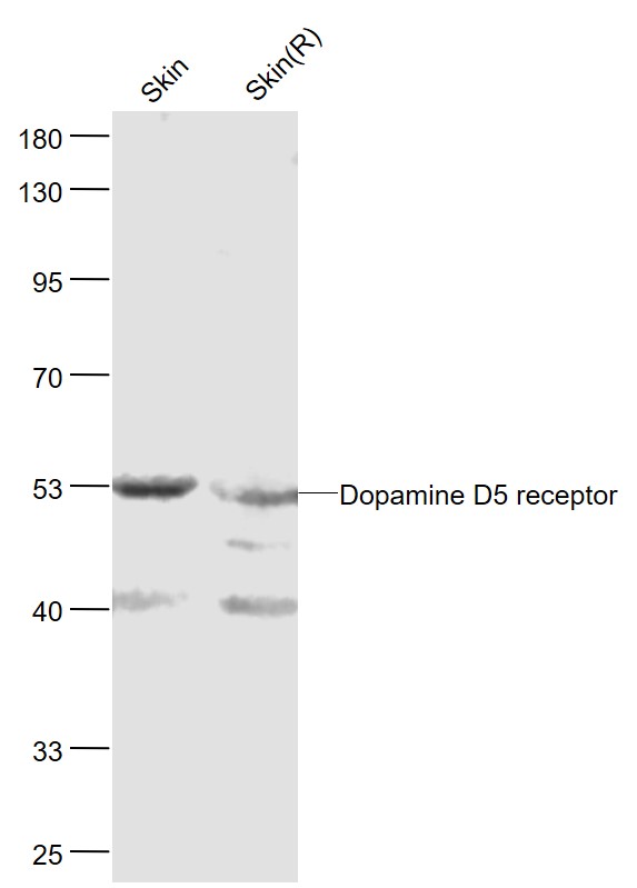 Lane 1: Mouse Skin lysates; Lane 2: Rat Skin lysates probed with DRD5\/Dopamine receptor 5 Polyclonal Antibody, Unconjugated (bs-1747R) at 1:1000 dilution and 4˚C overnight incubation. Followed by conjugated secondary antibody incubation at 1:20000 for 60 min at 37˚C.