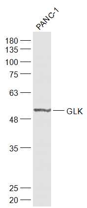 Lane 1: Panc-1 cell lysates probed with GCK/Glucokinase Polyclonal Antibody, Unconjugated (bs-1796R) at 1:1000 dilution and 4˚C overnight incubation. Followed by conjugated secondary antibody incubation at 1:20000 for 60 min at 37˚C.